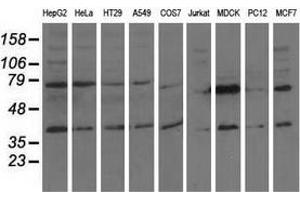 Western blot analysis of extracts (35 µg) from 9 different cell lines by using anti-CBWD1 monoclonal antibody. (CBWD1 抗体)