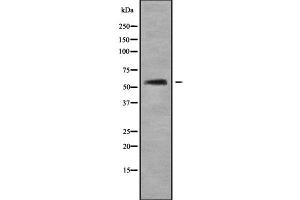 Western blot analysis of AGXT2 using COLO205 whole cell lysates (AGXT2 抗体  (Internal Region))