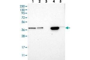 Western blot analysis of Lane 1: RT-4, Lane 2: U-251 MG, Lane 3: Human Plasma, Lane 4: Liver, Lane 5: Tonsil with SLC35E1 polyclonal antibody  at 1:250-1:500 dilution.