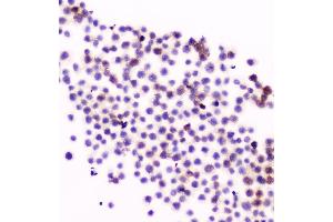IHC analysis of CD11a using anti-CD11a antibody (ABIN5518766). (ITGAL 抗体  (AA 161-349))