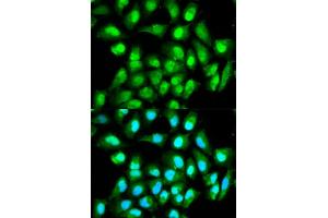 Immunofluorescence analysis of HeLa cells using RAN antibody (ABIN5970364). (RAN 抗体)