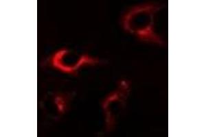 Immunofluorescent analysis of FKBP8 staining in A549 cells. (FKBP8 抗体)