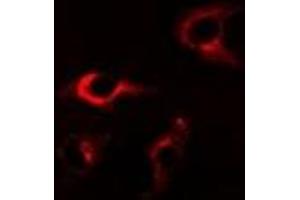 Immunofluorescent analysis of FKBP8 staining in A549 cells.