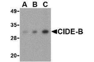 Western blot analysis of CIDE-B in mouse small intestine tissue lysate with AP30233PU-N CIDE-B antibody at (A) 0. (CIDEB 抗体  (Center))