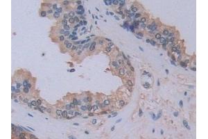 Immunohistochemistry (IHC) image for anti-Phosphatidylethanolamine Binding Protein 1 (PEBP1) (AA 2-187) antibody (ABIN7436330)