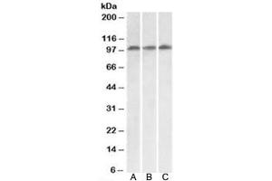 Western blot testing of HeLa [A], HepG2 [B] and Jurkat [C] lysates with VPS16 antibody at 0. (VPS16 抗体  (Isoform 1))