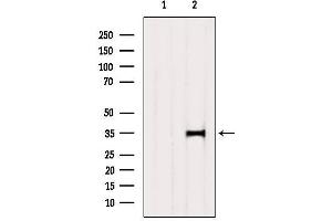 Western Blotting (WB) image for anti-Sulfotransferase Family, Cytosolic, 2A, Dehydroepiandrosterone (DHEA)-Preferring, Member 1 (SULT2A1) (C-Term) antibody (ABIN6265371)
