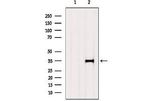 Western blot analysis of extracts from 3t3, using SULT2A1 Antibody. (SULT2A1 抗体  (C-Term))