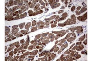 Image no. 4 for anti-Tuberous Sclerosis 1 (TSC1) (AA 836-1164) antibody (ABIN1491685)