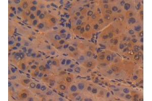 DAB staining on IHC-P; Samples: Human Liver Tissue (Sialoadhesin/CD169 抗体  (AA 34-240))