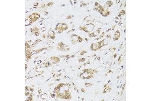 Immunohistochemistry (Paraffin-embedded Sections) (IHC (p)) image for anti-DNA Methyltransferase 1-Associated Protein 1 (DMAP1) (AA 1-305) antibody (ABIN6139677)