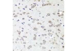Immunohistochemistry of paraffin-embedded mouse brain using IGFBP5 antibody (ABIN6292146) at dilution of 1:100 (40x lens). (IGFBP5 抗体)