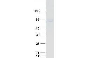 Validation with Western Blot