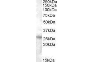 Western Blotting (WB) image for Ras Association (RalGDS/AF-6) Domain Family Member 3 (RASSF3) peptide (ABIN369335) (Ras Association (RalGDS/AF-6) Domain Family Member 3 (RASSF3) Peptide)