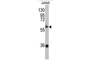 Western blot analysis of ZBTB2 antibody (C-term) in Jurkat cell line lysates (35ug/lane).
