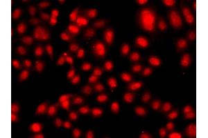 Immunofluorescence analysis of  cells using TE antibody (ABIN6128816, ABIN6148986, ABIN6148987 and ABIN6223335). (TEAD3 抗体  (AA 130-330))