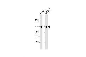 Western Blot at 1:1000 dilution Lane 1: Hela whole cell lysate Lane 2: MCF-7 whole cell lysate Lysates/proteins at 20 ug per lane.