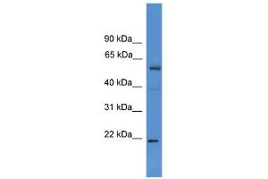 WB Suggested Anti-ASCL3 Antibody Titration:  0. (ASCL3 抗体  (C-Term))