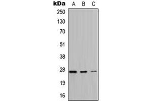 Western blot analysis of ATP6 expression in HeLa (A), A549 (B), PC12 (C) whole cell lysates. (MT-ATP6 抗体  (Center))