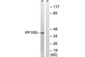 Western blot analysis of extracts from Jurkat cells, using PPP1R8 Antibody. (PPP1R8 抗体  (AA 196-245))