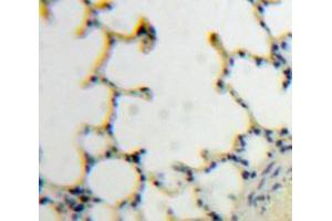 IHC-P analysis of Lung tissue, with DAB staining. (TLR7 抗体  (AA 890-1037))