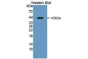 Detection of Recombinant SLC39A6, Human using Polyclonal Antibody to Solute Carrier Family 39, Member 6 (SLC39A6) (SLC39A6 抗体  (AA 29-325))