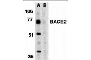 Western Blotting (WB) image for anti-beta-Site APP-Cleaving Enzyme 2 (BACE2) (C-Term) antibody (ABIN1030277)