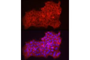 Immunofluorescence analysis of  cells using Fbx32/FBOX32 Rabbit pAb (ABIN3017561, ABIN3017562, ABIN3017563, ABIN1679825 and ABIN6220155) at dilution of 1:50 (40x lens). (FBXO32 抗体  (AA 206-355))