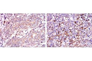 Immunohistochemistry (IHC) image for anti-Survival of Motor Neuron 1, Telomeric (SMN1) antibody (ABIN969408)