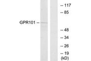 Western blot analysis of extracts from COS7 cells, using GPR101 Antibody. (GPR101 抗体  (AA 451-500))