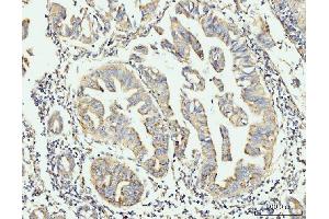 IHC analysis of GRPEL1 using anti-GRPEL1 antibody (ABIN7602643). (GRPEL1 抗体  (AA 90-217))