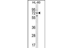 MBTD1 Antibody (C-term) (ABIN655319 and ABIN2844896) western blot analysis in HL-60 cell line lysates (35 μg/lane). (MBTD1 抗体  (C-Term))