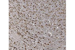 IHC analysis of FOXP1 using anti-FOXP1 antibody (ABIN7602780). (FOXP1 抗体  (C-Term))