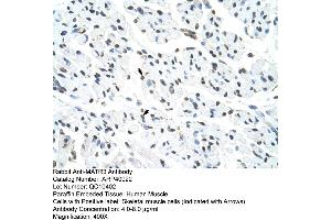 Rabbit Anti-MATR3 Antibody  Paraffin Embedded Tissue: Human Muscle Cellular Data: Skeletal muscle cells Antibody Concentration: 4. (MATR3 抗体  (N-Term))
