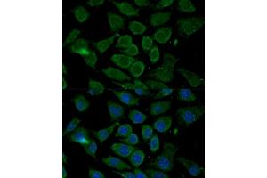 Immunofluorescence analysis of L929 cells using Bcl-2 antibody (ABIN3016825, ABIN3016826, ABIN3016827 and ABIN6219850) at dilution of 1:100. (Bcl-2 抗体  (AA 81-131))