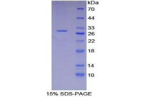 SDS-PAGE analysis of Mouse XRCC6 Protein. (XRCC6 蛋白)