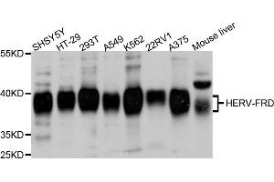 Western blot analysis of extracts of various cell lines, using ERVFRD-1 antibody (ABIN6003860) at 1/1000 dilution. (HERV-FRD Provirus Ancestral Env Polyprotein (Herv-frd) 抗体)
