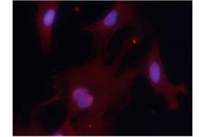 Immunofluorescence staining of methanol-fixed MEF cells using PKM1 Antibody Cat.