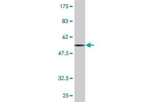 Western Blot detection against Immunogen (52. (MED6 抗体  (AA 1-246))