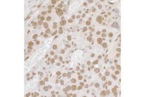anti-Fused in Sarcoma (FUS) (AA 1-50) antibody