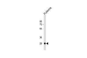 Anti-CFD Antibody (N-term) at 1:2000 dilution + human plasma lysate Lysates/proteins at 20 μg per lane.