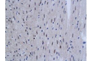 Formalin-fixed and paraffin embedded mouse myocardial tissue labeled with Anti SnoN Polyclonal Antibody, Unconjugated  followed by conjugation to the secondary antibody and DAB staining (SKIL 抗体  (AA 301-400))