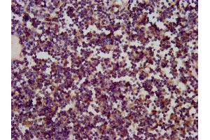 IHC image of ABIN7170587 diluted at 1:200 and staining in paraffin-embedded human lymph node tissue performed on a Leica BondTM system. (SKA1 抗体  (AA 61-134))