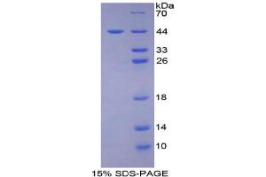 SDS-PAGE analysis of Human CD2 Associated Protein. (CD2AP 蛋白)
