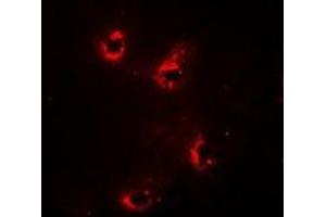Immunofluorescent analysis of Alpha-crystallin A staining in Hela cells. (CRYAA 抗体)
