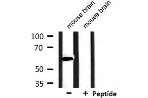 Western blot analysis of extracts from mouse brain, using HNRPLL Antibody.