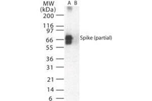 Image no. 1 for anti-SARS-Coronavirus Spike Protein (SARS-CoV S) (AA 19-35) antibody (ABIN199980) (SARS-CoV Spike 抗体  (AA 19-35))