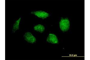 Immunofluorescence of purified MaxPab antibody to HOXB1 on HeLa cell. (HOXB1 抗体  (AA 1-235))