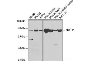 Western blot analysis of extracts of various cell lines using ZNF195 Polyclonal Antibody at dilution of 1:1000. (ZNF195 抗体)