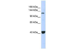 PIWIL1 antibody used at 1 ug/ml to detect target protein. (PIWIL1 抗体)
